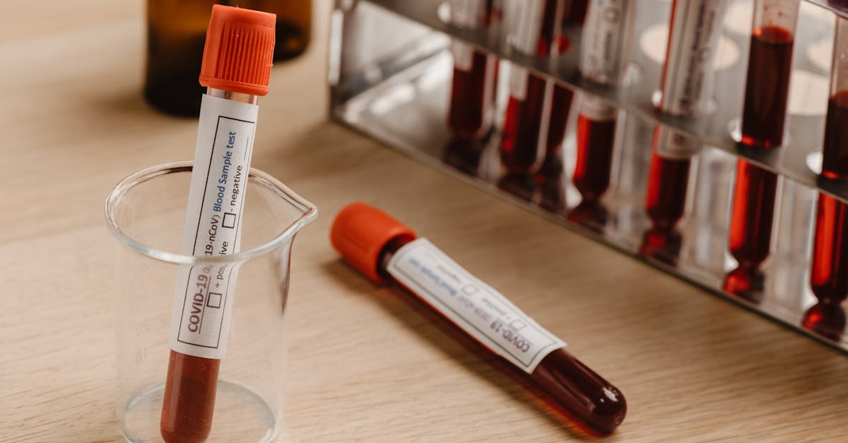 Ultrasonido Cromosómico en Cuautitlán