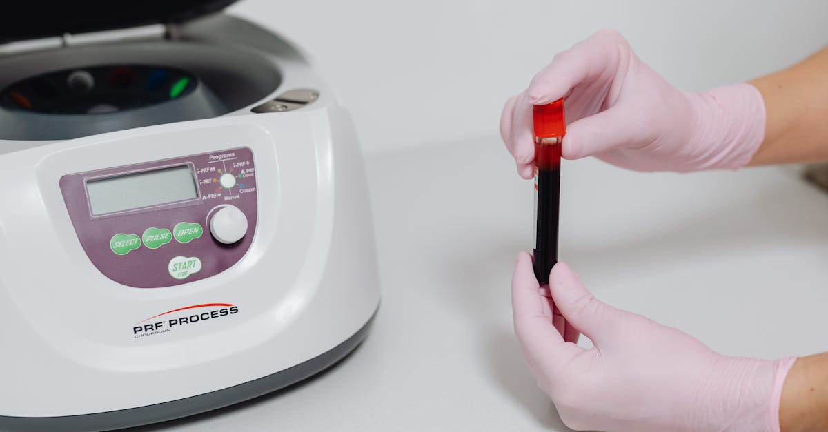 Radiografia AP y Lateral de los Manos en Cuautitlán